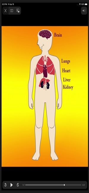 Body Parts - Internal(圖6)-速報App