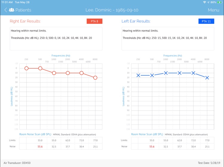 SHOEBOX Audiometry Pro screenshot-9