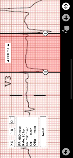 ECG Caliper(圖3)-速報App