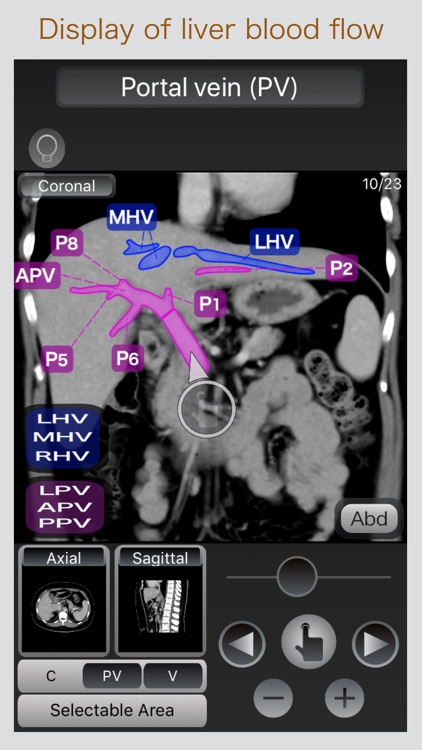 CT Passport Abdomen