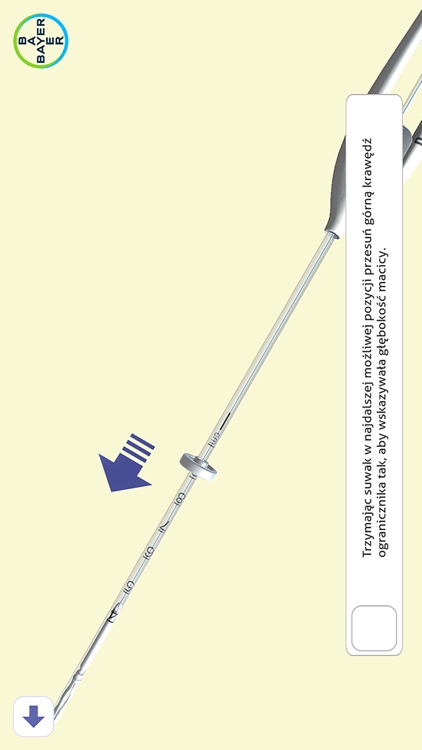 IUS Insertion screenshot-3