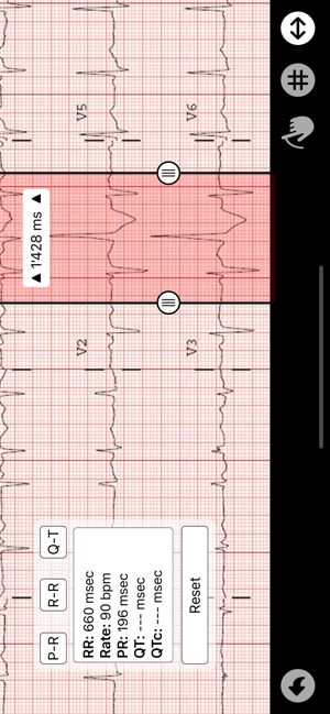 ECG Caliper(圖4)-速報App