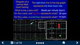 Game screenshot Fetal Heart Rate - SecondLook apk