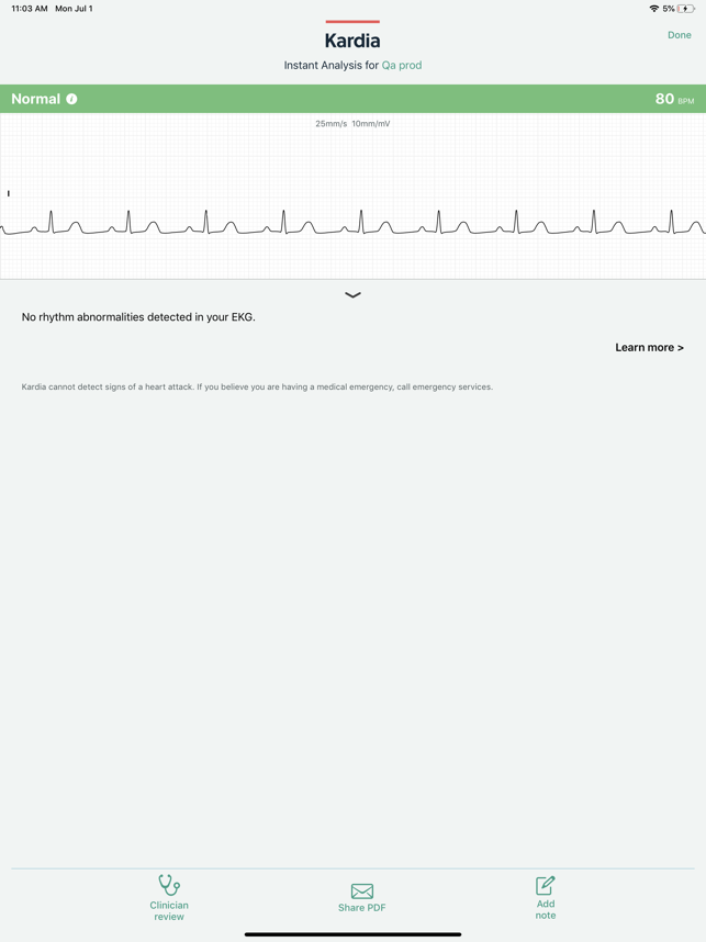 643x0w AliveCor Kardia Mobile - EKG für die Hosentasche im Test Gadgets Smartphones Tablets Technologie Testberichte 