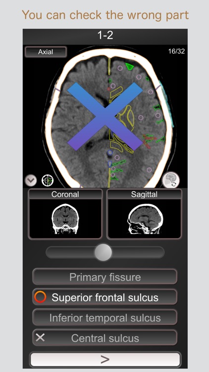 CT PassQuiz Head/Brain / MRI