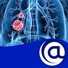 Top 45 Medical Apps Like Non-Small Cell Lung Cancer - Best Alternatives
