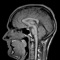 MRIcontrast™ is a truly interactive simulator for magnetic resonance imaging (MRI)