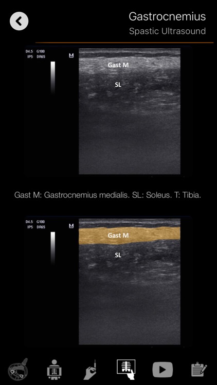 Muscle Patterns