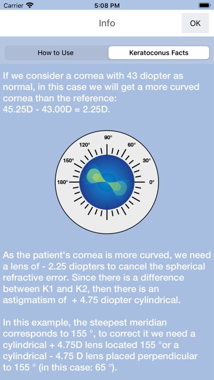 Helper Keratoconus