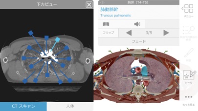 ヒューマン・アナトミー・アトラス2019 screenshot1