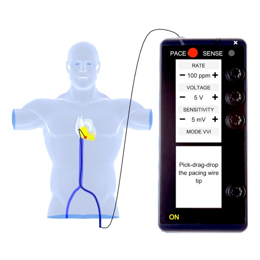 Temporary Cardiac Pacing