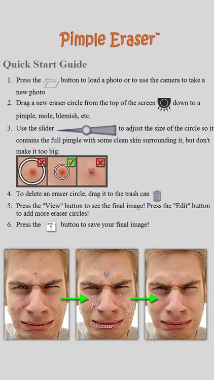 Pimple Eraser LITE screenshot-4