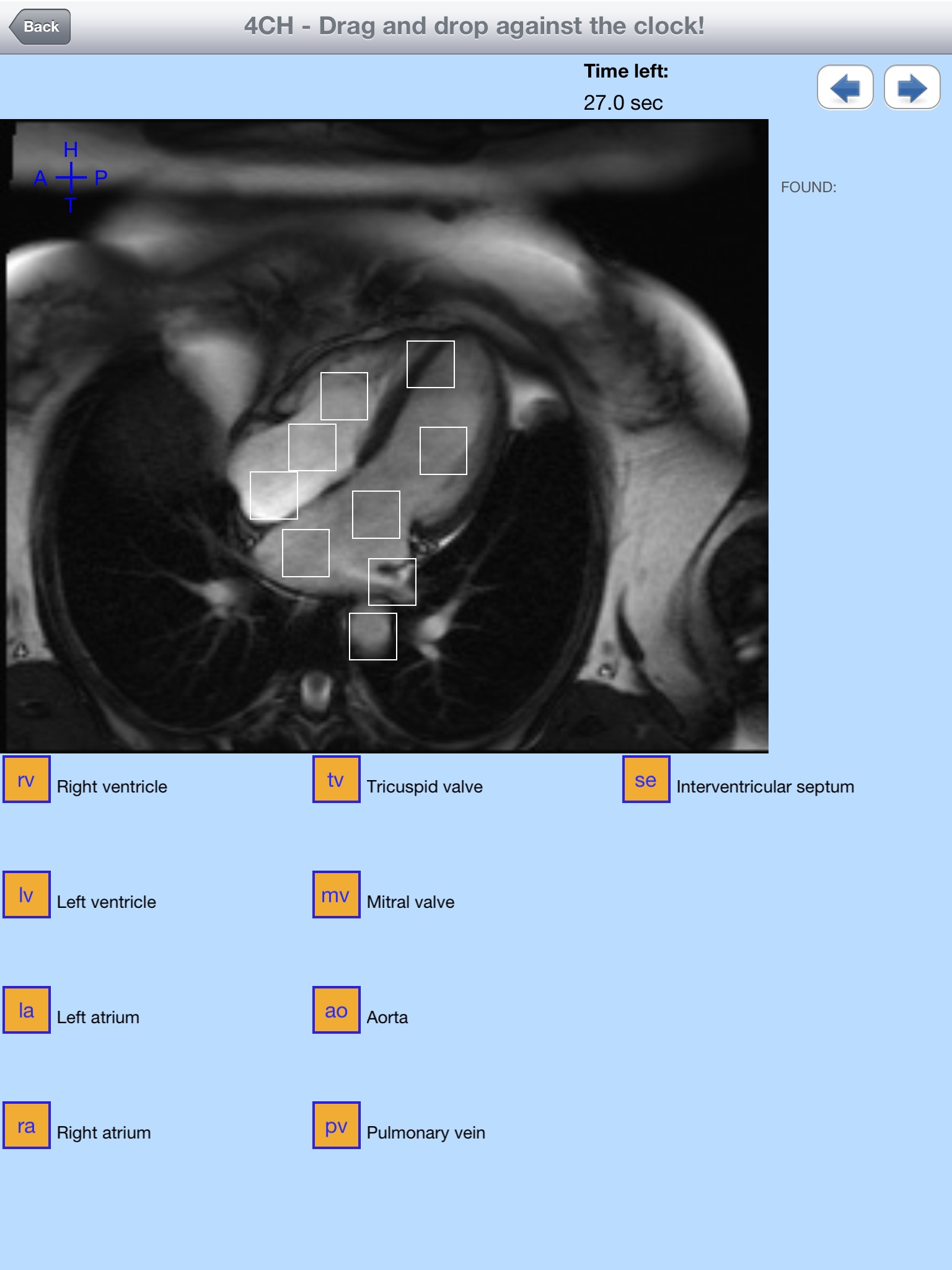 iAnatomy-Cardiac screenshot 4