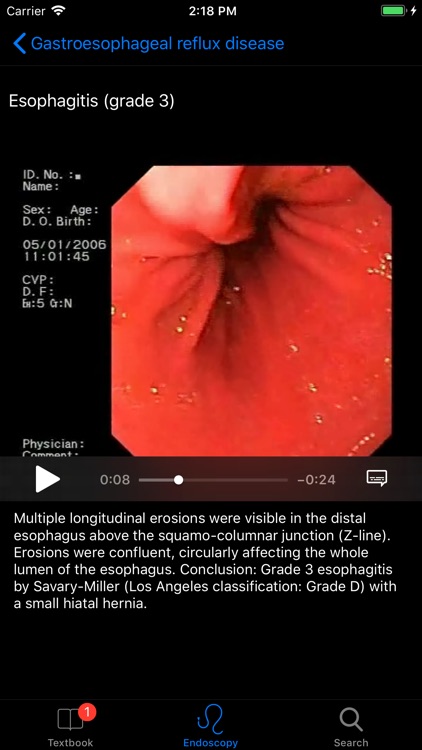 ENDO3® Gastrointestinal Atlas screenshot-3