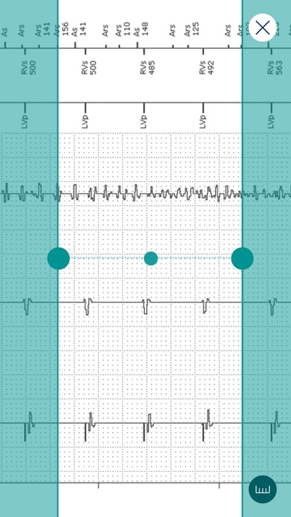 BIOTRONIK Device Expert screenshot-4