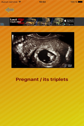 FingerPrint Pregnant Test screenshot 4