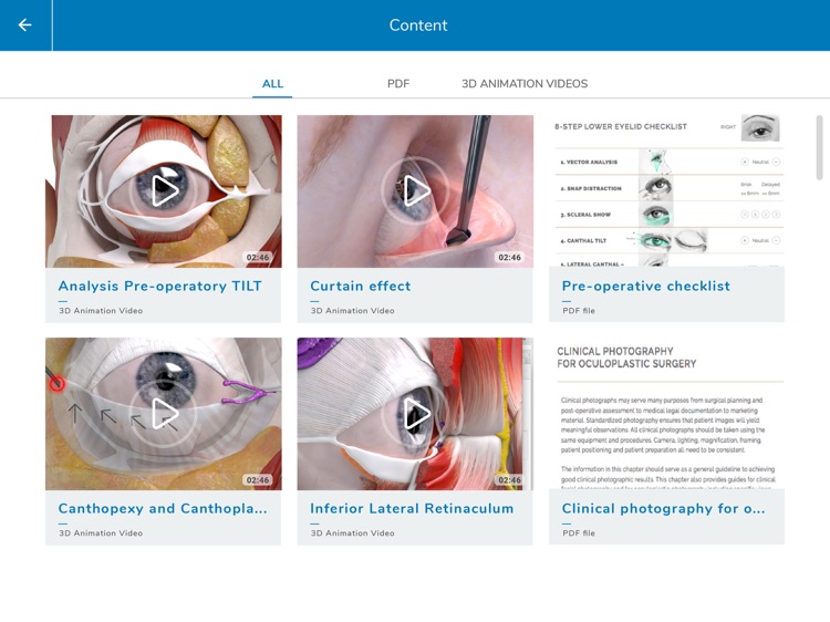 Beut Jelks Oculoplasty by 3D TECH OMEGA ZETA S.L