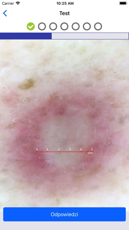 Testy Akademia Dermatoskopii