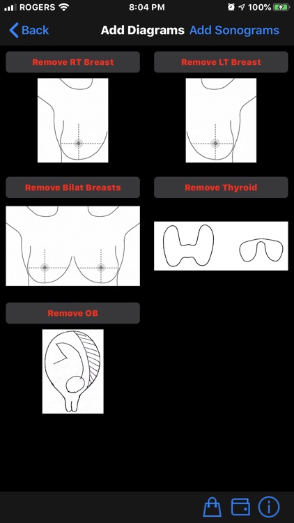 Ultrasound Reporting Tool screenshot-3