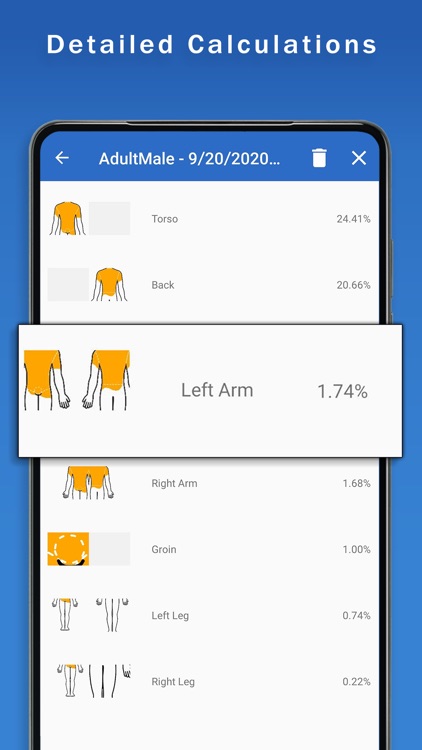 Surface Burn Calculator