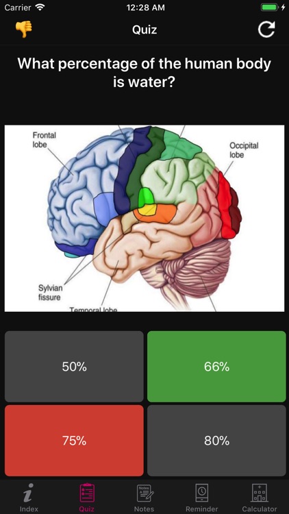 Human Brain Facts & Quiz 2000 screenshot-6