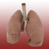Non-Small-Cell Lung Cancer