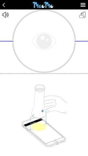 MeoMo视力(圖1)-速報App