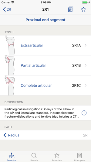 AO/OTA Fracture Classification(圖2)-速報App