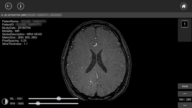 DICOM Viewer : eMma(圖2)-速報App