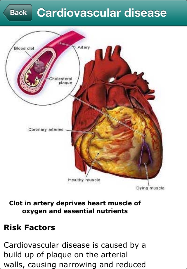 Cardiovascular Risk Calculator screenshot 4