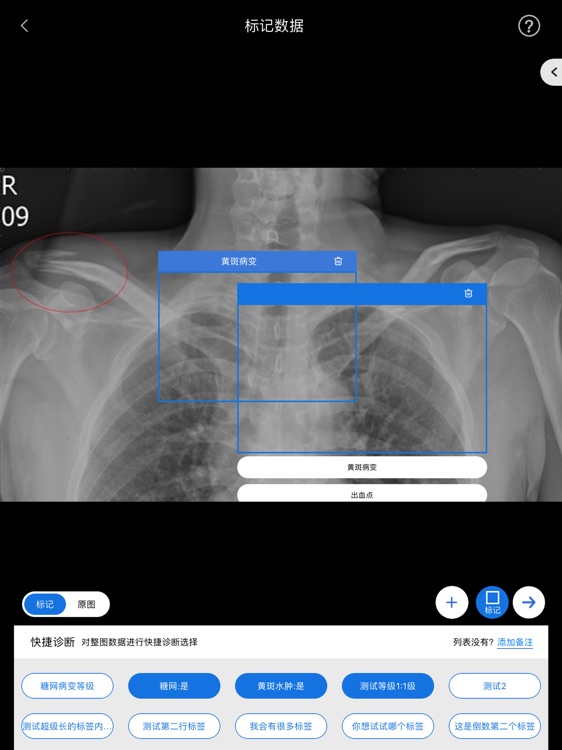肽积木医疗影像移动标记平台 screenshot-4