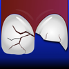 ToothSOS - International Association of Dental Traumatology