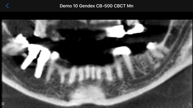 Dental CT View screenshot-6