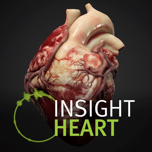 INSIGHT HEART Download