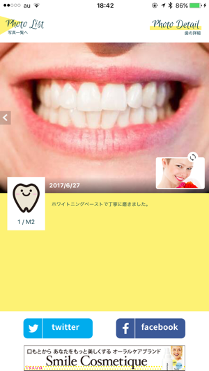 Smile Cosmetique  白い歯日記(圖3)-速報App