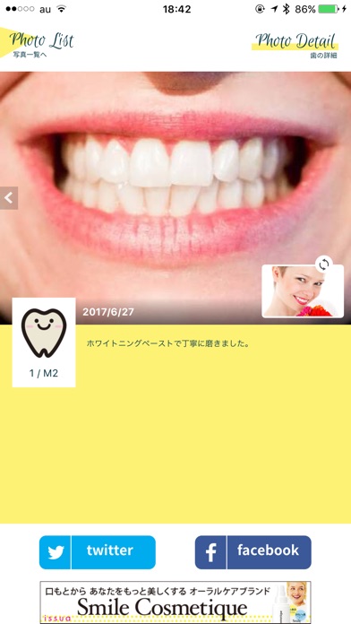 Smile Cosmetique 白い歯日記のスクリーンショット3 Smile Cosmetique 白い歯日記のスクリーンショット3