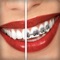 Are you tired of having perfect teeth
