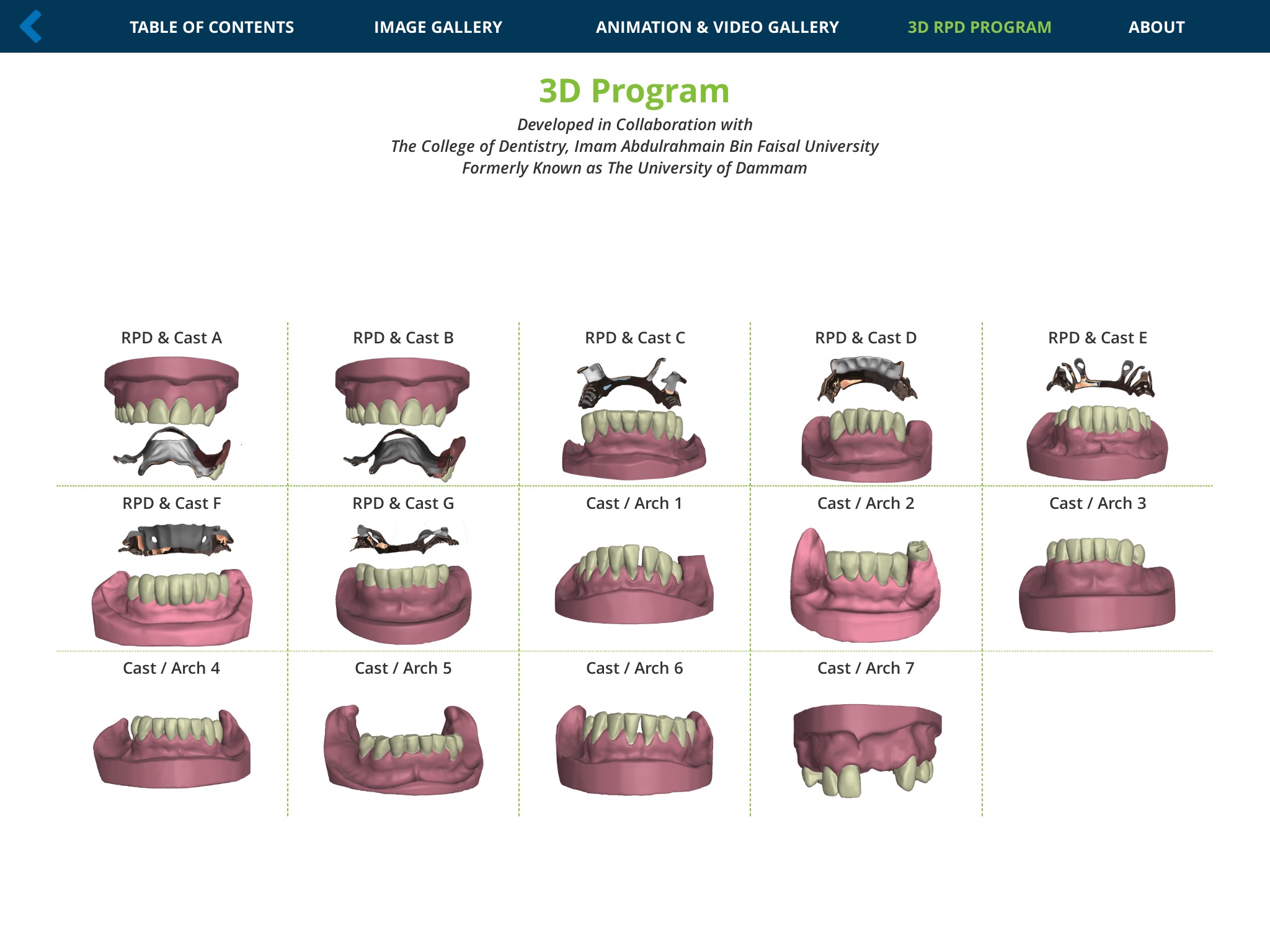 Removable Partial Dentures screenshot 2