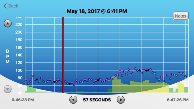 HRV Trace(圖1)-速報App