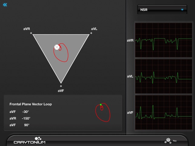 Craytonium ECG(圖4)-速報App