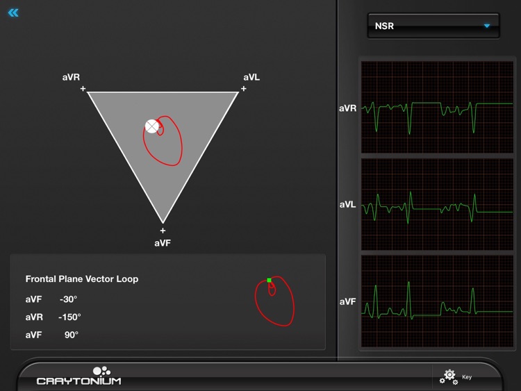 Craytonium ECG screenshot-3