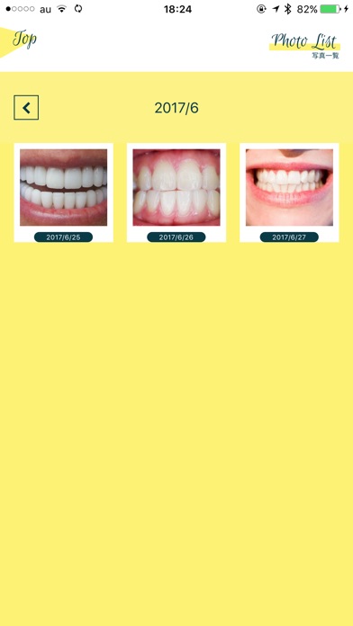 Smile Cosmetique 白い歯日記のスクリーンショット5 Smile Cosmetique 白い歯日記のスクリーンショット5