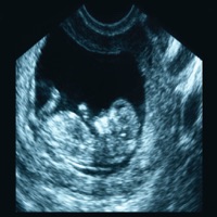 ARDMS OBGYN + Abdomen Boards Ultrasound Flashcards  PC 용