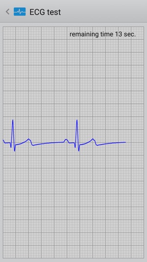 Istel ECG(圖2)-速報App