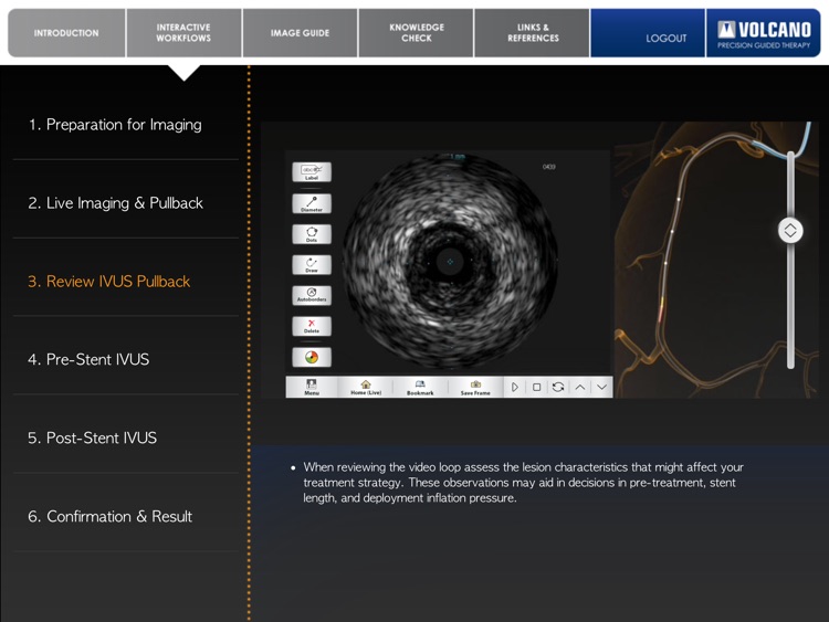 Coronary IVUS Essential Training