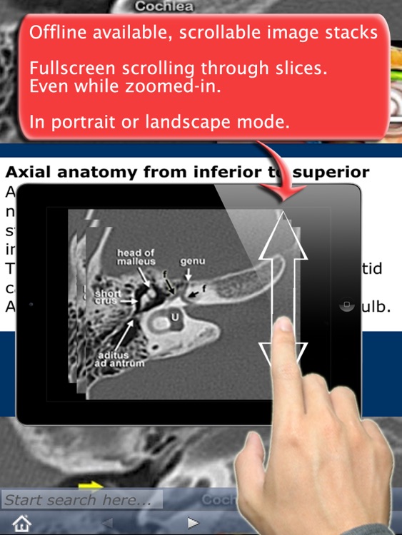 Radiology Assistant for iPad - Imaging Reference