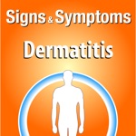 Signs  Symptoms Dermatitis
