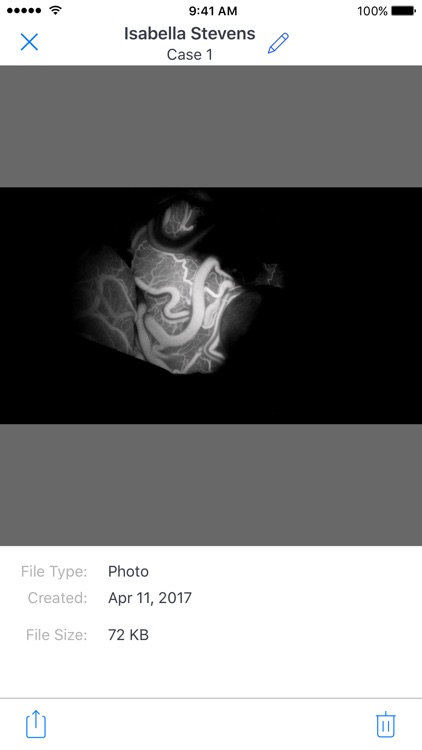 ZEISS Transfer screenshot-3