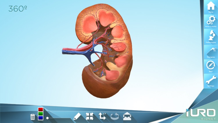 iURO Kidney PRO screenshot-3