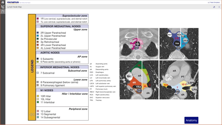 LC Staging screenshot-4